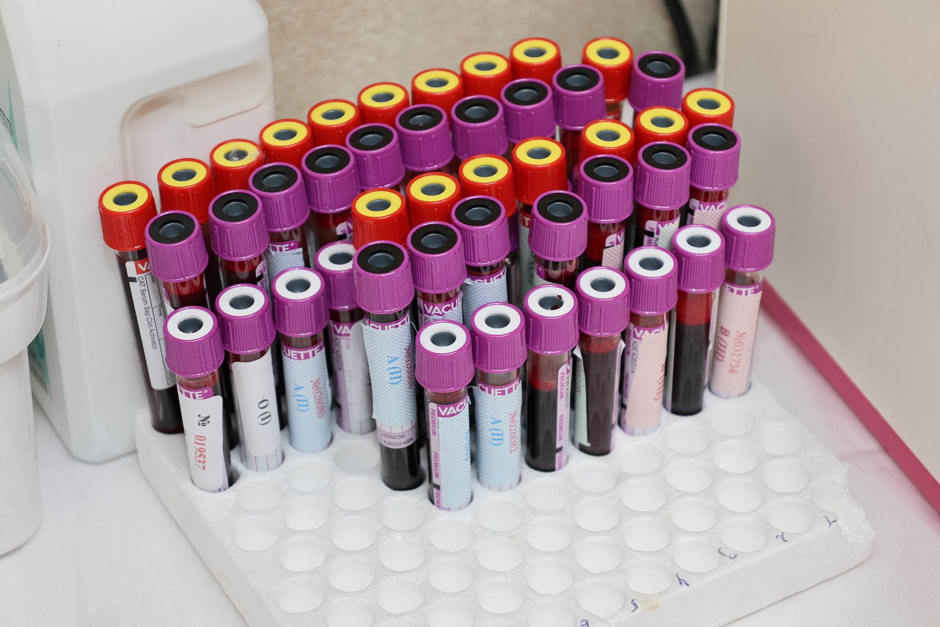 Racked blood sample tubes ready for panel testing